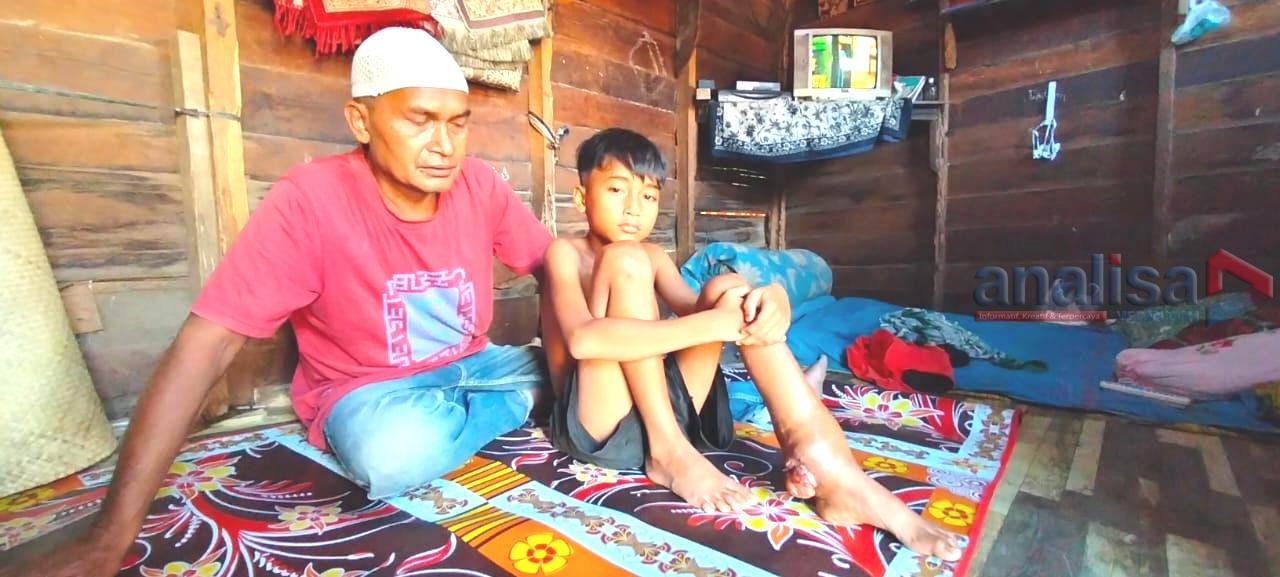 Anak Petani Miskin Penderita Tumor Ganas di Sidimpuan Pasrah Tak Punya Biaya Berobat