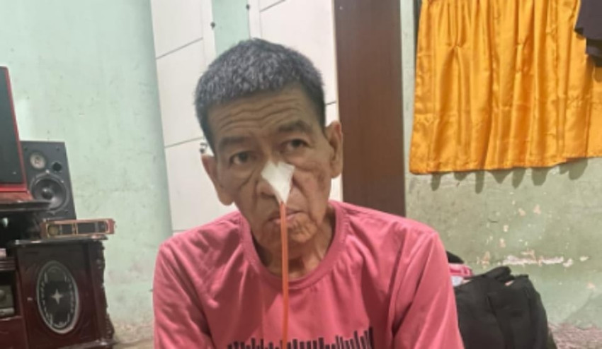 Derita Kanker Orofaringeal, Warga Padangsidimpuan Ini Butuh Perhatian