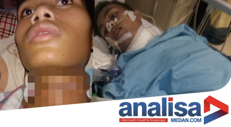 Leher Santri di Tapsel Disayat Pakai Cutter Hanya Gara-Gara Uang Rp.10 Ribu
